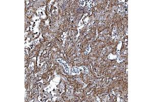 IHC analysis of EHD3 using anti-EHD3 antibody (ABIN7602777). (EHD3 anticorps  (C-Term))