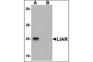Western blot analysis of LIAR in mouse kidney tissue lysate with this product at 1 μg/ml in (A) the absence and (B) the presence of blocking peptide. (ANKRD54 anticorps  (C-Term))