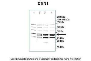 Lanes:   1. (CNN1 anticorps  (N-Term))