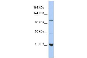 WB Suggested Anti-MTHFD1 Antibody Titration:  0.