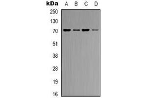 Western blot analysis of KEAP1 expression in K562 (A), Hela (B), mouse heart (C), mouse brain (D) whole cell lysates. (KEAP1 anticorps)