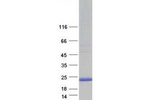 Validation with Western Blot