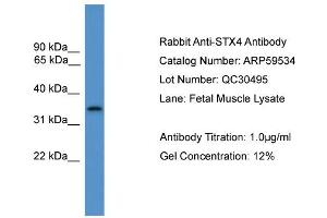 WB Suggested Anti-STX4  Antibody Titration: 0. (Syntaxin 4 anticorps  (C-Term))