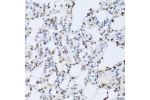 Immunohistochemistry of paraffin-embedded rat lung using MAPK3 Antibody (ABIN5970057) at dilution of 1/100 (40x lens). (ERK1 anticorps  (N-Term))
