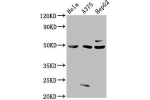 Western Blot Positive WB detected in: Hela whole cell lysate, A375 whole cell lysate, HepG2 whole cell lysate All lanes: STK24 antibody at 3 μg/mL Secondary Goat polyclonal to rabbit IgG at 1/50000 dilution Predicted band size: 50, 48 kDa Observed band size: 50 kDa (STK24 anticorps  (AA 1-431))