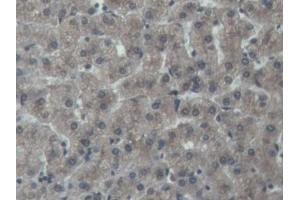 DAB staining on IHC-P; Samples: Porcine Liver Tissue