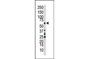 Western blot analysis of anti-TAK1 Pab (ABIN392466 and ABIN2842053) in HL60 cell lysate.