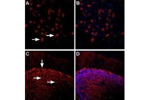Expression of β1-Adrenoceptor in rat and mouse brain - Immunohistochemical staining of rat dorsal raphe nucleus and mouse cerebellum using Anti-β1-Adrenergic Receptor (extracellular) Antibody (ABIN7042902, ABIN7043924 and ABIN7043925), (1:400).