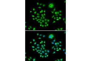 Immunofluorescence (IF) image for anti-HIV-1 Rev Binding Protein (HRB) antibody (ABIN1980310) (AGFG1 anticorps)