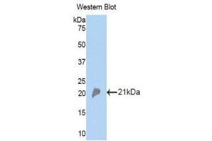 Western Blotting (WB) image for anti-Complement Factor P (CFP) (AA 310-459) antibody (ABIN3207871) (CFP anticorps  (AA 310-459))