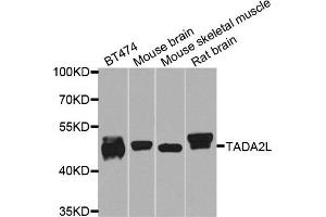Western blot analysis of extracts of various cells, using TADA2A antibody. (TADA2L anticorps)