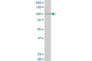SIX4 monoclonal antibody (M05), clone 3B8 Western Blot analysis of SIX4 expression in Hela S3 NE . (SIX4 anticorps  (AA 672-780))