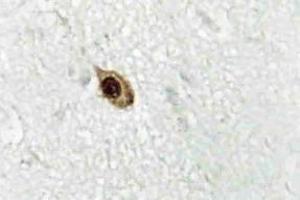 Immunohistochemistry (IHC) analyzes of Zic1/2/3 antibody in paraffin-embedded human brain tissue. (ZIC1 anticorps)