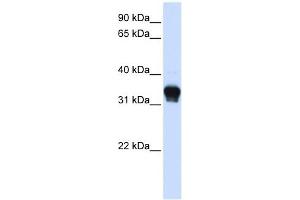 CK1 alpha 1 antibody used at 1 ug/ml to detect target protein. (CK1 alpha 1 (C-Term) anticorps)