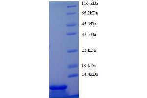 SDS-PAGE (SDS) image for Chemokine (C-X-C Motif) Ligand 5 (CXCL5) (AA 46-117), (partial) protein (His tag) (ABIN1046743)