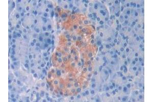 Detection of CBG in Human Pancreas Tissue using Polyclonal Antibody to Corticosteroid Binding Globulin (CBG)