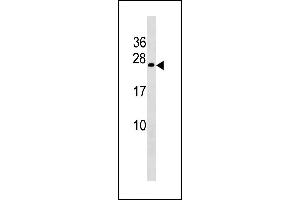 COX4NB Antibody (Center) (ABIN1881224 and ABIN2843225) western blot analysis in A549 cell line lysates (35 μg/lane). (COX4NB anticorps  (AA 78-106))
