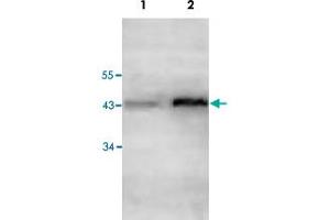 Western blot analysis of human fetal cartilage (Lane 1) and human fetal kidney (Lane 2) lysate with ACAA1 polyclonal antibody  at 1 : 500 dilution. (ACAA1 anticorps  (AA 210-424))