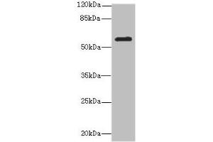 Western blot All lanes: MMP19antibody at 2. (MMP19 anticorps  (AA 209-508))