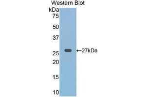 Detection of Recombinant FZD1, Human using Polyclonal Antibody to Frizzled Homolog 1 (FZD1) (FZD1 anticorps  (AA 117-322))