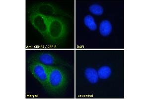 ABIN190893 Immunofluorescence analysis of paraformaldehyde fixed MCF7 cells, permeabilized with 0. (CRHR1 anticorps  (AA 250-263))