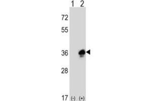 Western Blotting (WB) image for anti-Myelin Protein Zero (MPZ) antibody (ABIN3003838) (MPZ anticorps)