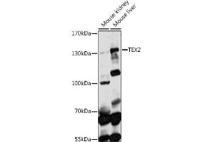 Western blot analysis of extracts of various cell lines, using TEX2 antibody (ABIN7270775) at 1:1000 dilution. (TEX2 anticorps  (AA 915-1134))