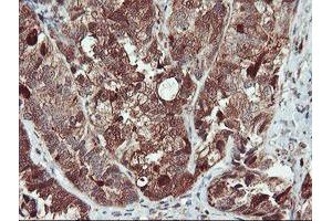 Image no. 4 for anti-serpin Peptidase Inhibitor, Clade B (Ovalbumin), Member 1 (SERPINB1) (AA 77-306) antibody (ABIN1491670)