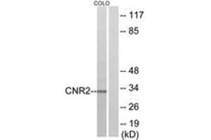 Western blot analysis of extracts from COLO205 cells, using CNR2 Antibody. (CNR2 anticorps  (AA 191-240))