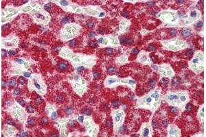 Liver, Human: Formalin-Fixed, Paraffin-Embedded (FFPE)