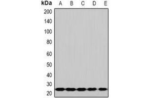 Western blot analysis of RPS5 expression in Hela (A), HepG2 (B), Jurkat (C), mouse spleen (D), mouse lung (E) whole cell lysates. (RPS5 anticorps)