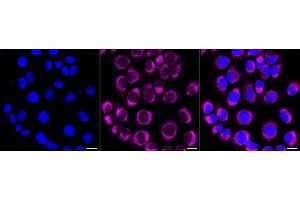 Immunocytochemical staining of HT- cells with PTPN1/2 antibody (ABIN7800964), 1:1,000). (Recombinant PTPN1/PTPN2 anticorps)