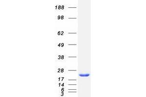 ADP-Ribosylation Factor 5 (ARF5) protein (Myc-DYKDDDDK Tag)