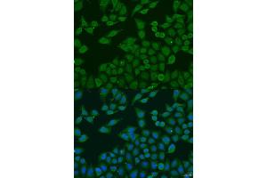 Immunofluorescence analysis of U2OS cells using PLG4C antibody (ABIN6132097, ABIN6145730, ABIN6145731 and ABIN6223698) at dilution of 1:100. (PLA2G4C anticorps  (AA 1-189))