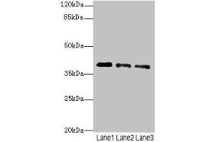 Western blot All lanes: RP2antibody at 3. (RP2 anticorps  (AA 1-350))