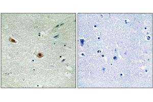 Immunohistochemical analysis of paraffin-embedded human brain tissue using Retinoblastoma (Phospho-Ser608) antibody (left)or the same antibody preincubated with blocking peptide (right).