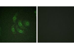 Peptide - +Immunofluorescence analysis of HepG2 cells, using CaMK4 (Ab-196/200) antibody. (CAMK4 anticorps  (Thr196))