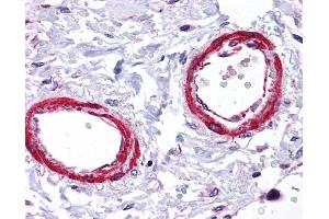 Immunohistochemistry (IHC) image for anti-Sirtuin 5 (SIRT5) (Middle Region) antibody (ABIN405300) (SIRT5 anticorps  (Middle Region))