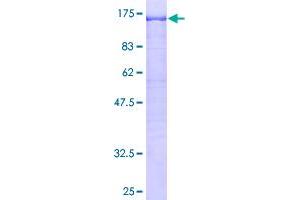 Image no. 1 for Collagen, Type III, alpha 1 (COL3A1) (AA 25-1163) protein (GST tag) (ABIN1349965)