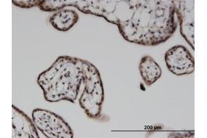 Image no. 1 for anti-Integrin-Linked Kinase-Associated Serine/threonine Phosphatase 2C (ILKAP) (AA 293-393) antibody (ABIN599593) (ILKAP anticorps  (AA 293-393))