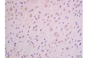 Formalin-fixed and paraffin embedded mouse brain labeled with Anti-GHRH Polyclonal Antibody, Unconjugated (ABIN726275) at 1:300 followed by conjugation to the secondary antibody and DAB staining.