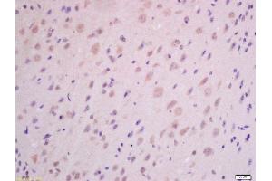 Formalin-fixed and paraffin embedded mouse brain labeled with Anti-GHRH Polyclonal Antibody, Unconjugated (ABIN726275) at 1:300 followed by conjugation to the secondary antibody and DAB staining. (GHRH anticorps  (AA 32-59))