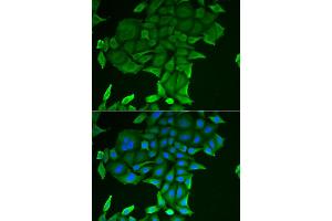 Immunofluorescence analysis of HeLa cells using CD84 antibody (ABIN5973833).
