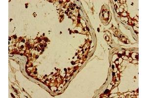 Immunohistochemistry of paraffin-embedded human testis tissue using ABIN7152561 at dilution of 1:100 (BRIP1 anticorps  (AA 66-243))