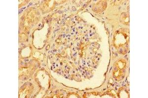 Immunohistochemistry of paraffin-embedded human kidney tissue using ABIN7146833 at dilution of 1:100 (CPT1A anticorps  (AA 301-600))