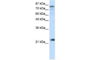 WB Suggested Anti-NFYB Antibody Titration:  0. (NFYB anticorps  (N-Term))