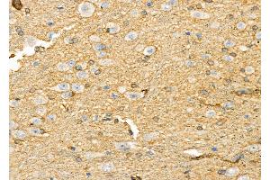 ABIN6265732 and ABIN6278120 at 1/100 staining Rat brain tissue by IHC-P.