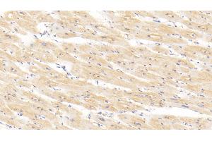 Detection of BMP2 in Human Cardiac Muscle Tissue using Polyclonal Antibody to Bone Morphogenetic Protein 2 (BMP2) (BMP2 anticorps  (AA 24-396))