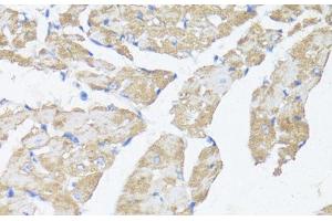 Immunohistochemistry of paraffin-embedded Mouse heart using ASMT Polyclonal Antibody at dilution of 1:100 (40x lens). (ASMT anticorps)