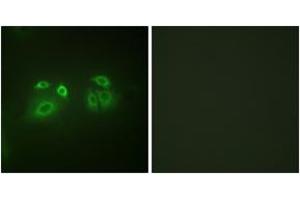 Immunofluorescence (IF) image for anti-Arrestin, beta 1 (ARRB1) (AA 369-418) antibody (ABIN2888645) (beta Arrestin 1 anticorps  (AA 369-418))